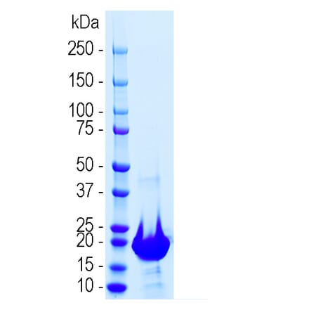 SDS-PAGE - Recombinant Human Neurofilament Light Polypeptide (A270596) - Antibodies.com