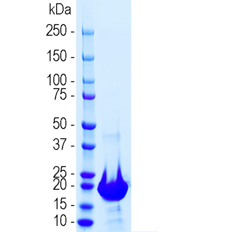 SDS-PAGE - Recombinant Human NF-L Polypeptide (A270596) - Antibodies.com