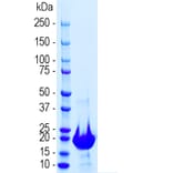 SDS-PAGE - Recombinant Human NF-L Polypeptide (A270596) - Antibodies.com