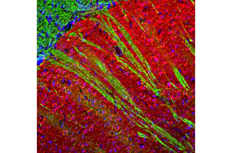 Immunofluorescence - Anti-MAP2 Antibody (A270598) - Antibodies.com