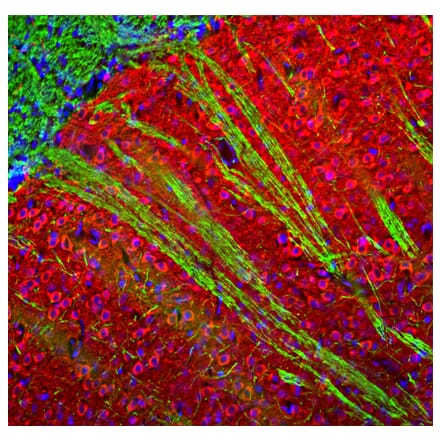 Immunofluorescence - Anti-MAP2 Antibody (A270598) - Antibodies.com