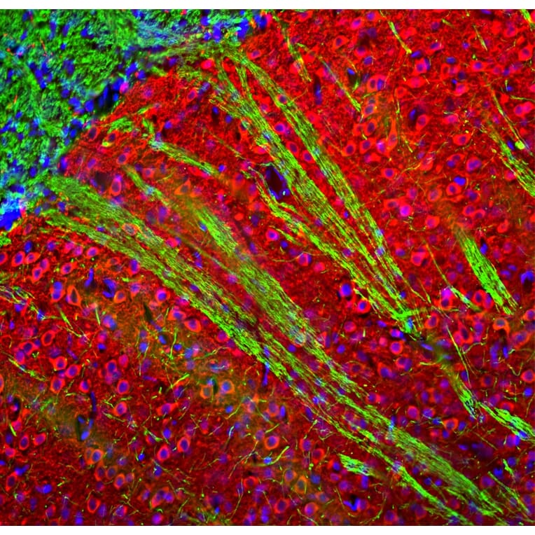 Immunofluorescence - Anti-MAP2 Antibody (A270598) - Antibodies.com