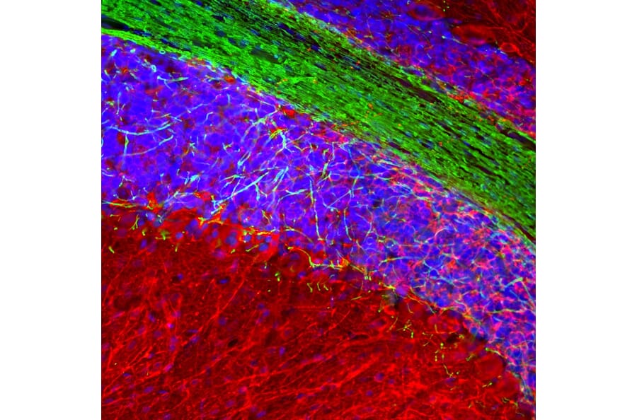Immunofluorescence - Anti-MAP2 Antibody (A270598) - Antibodies.com