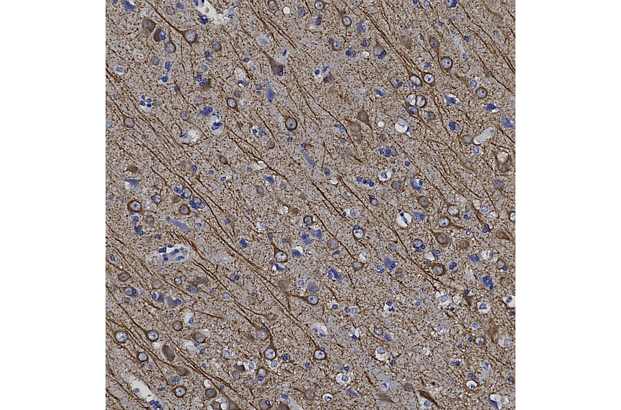 Immunohistochemistry - Anti-MAP2 Antibody (A270598) - Antibodies.com