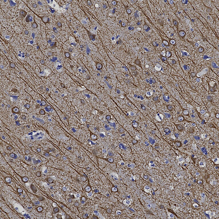 Immunohistochemistry - Anti-MAP2 Antibody (A270598) - Antibodies.com