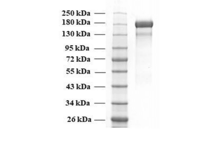 SDA-PAGE - Recombinant SARS-CoV-2 Spike Protein (B.1.617.2 Variant) (Functional) (A270599) - Antibodies.com