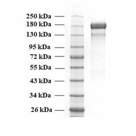 SDA-PAGE - Recombinant SARS-CoV-2 Spike Protein (B.1.617.2 Variant) (Functional) (A270599) - Antibodies.com