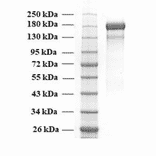 SDA-PAGE - Recombinant SARS-CoV-2 Spike Protein (B.1.617.2 Variant) (Functional) (A270599) - Antibodies.com