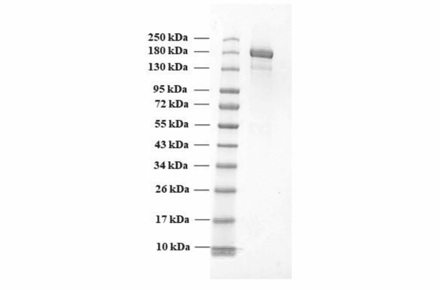 SDA-PAGE - Recombinant SARS-CoV-2 Spike Protein (B.1.1.7 Variant) (Functional) (A270600) - Antibodies.com