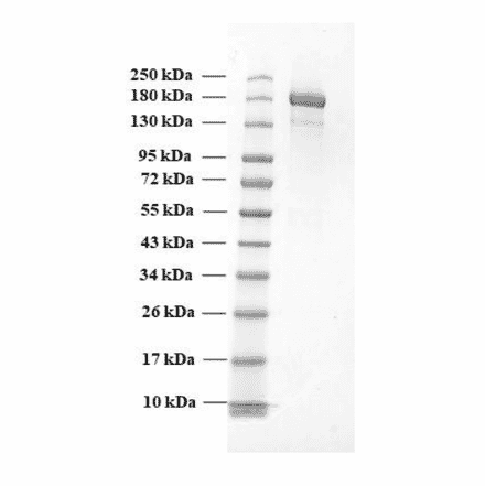 SDA-PAGE - Recombinant SARS-CoV-2 Spike Protein (B.1.1.7 Variant) (Functional) (A270600) - Antibodies.com