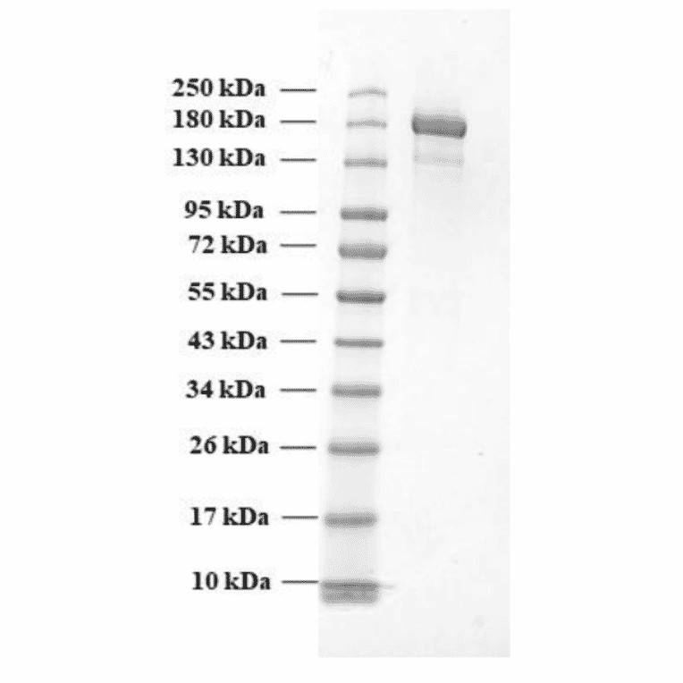 SDA-PAGE - Recombinant SARS-CoV-2 Spike Protein (B.1.1.7 Variant) (Functional) (A270600) - Antibodies.com