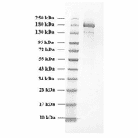 SDA-PAGE - Recombinant SARS-CoV-2 Spike Protein (B.1.1.7 Variant) (Functional) (A270600) - Antibodies.com