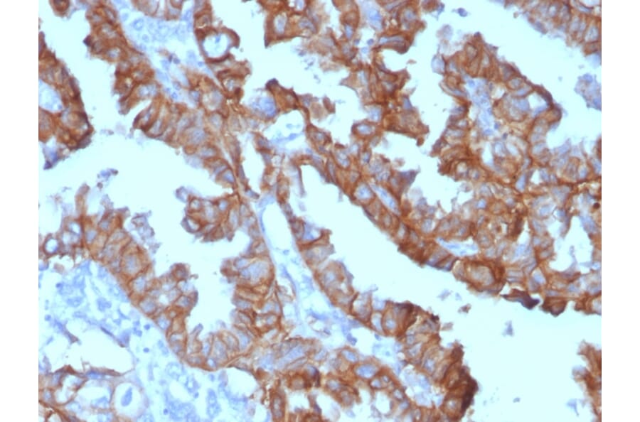Immunohistochemistry - Anti-EpCAM Antibody [EGP40/1372] (HRP) (A277522) - Antibodies.com
