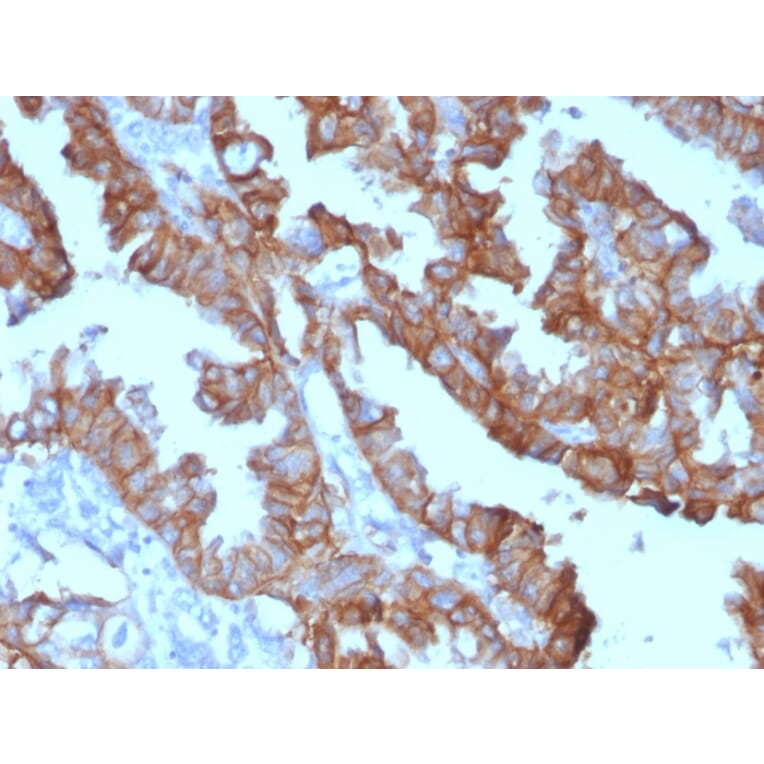 Immunohistochemistry - Anti-EpCAM Antibody [EGP40/1372] (HRP) (A277522) - Antibodies.com