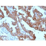 Immunohistochemistry - Anti-EpCAM Antibody [EGP40/1372] (HRP) (A277522) - Antibodies.com