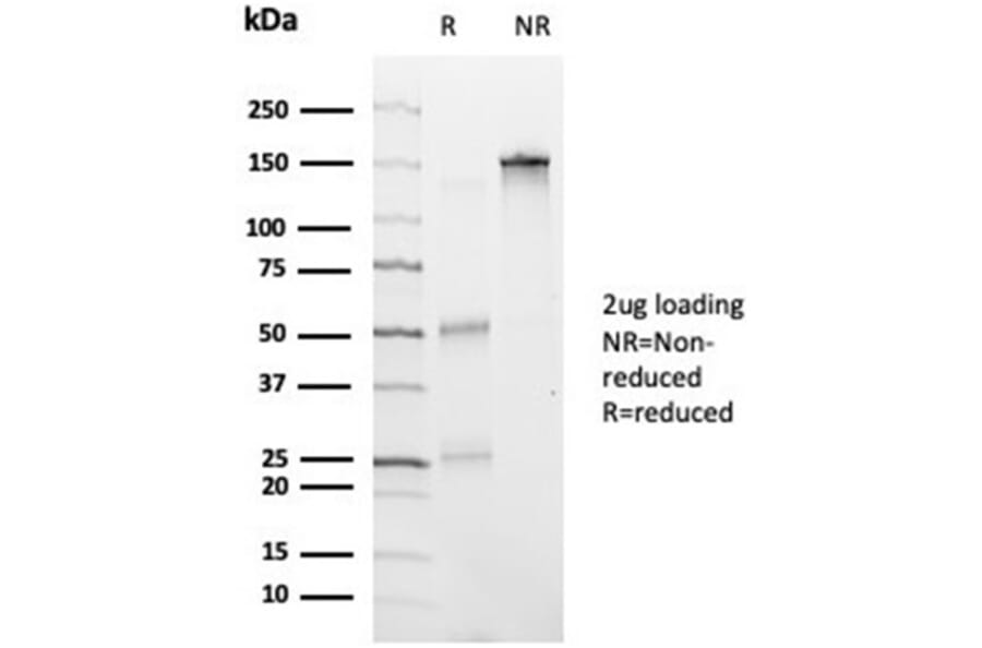 SDS-PAGE - Anti-HDAC6 Antibody [PCRP-HDAC6-1A4] (A277523) - Antibodies.com