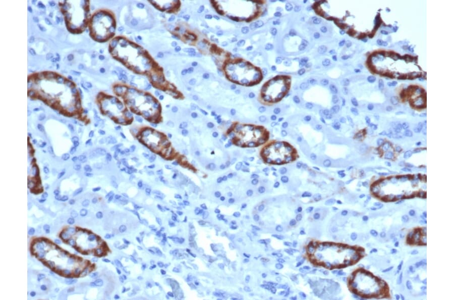 Immunohistochemistry - Anti-TOM1L1 Antibody [TOM1L1/4690] (A277525) - Antibodies.com