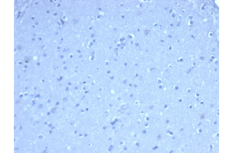 Immunohistochemistry - Anti-TOM1L1 Antibody [TOM1L1/4690] (A277525) - Antibodies.com
