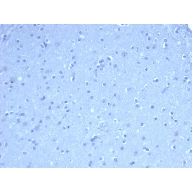 Immunohistochemistry - Anti-TOM1L1 Antibody [TOM1L1/4690] (A277525) - Antibodies.com