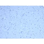 Immunohistochemistry - Anti-TOM1L1 Antibody [TOM1L1/4690] (A277525) - Antibodies.com