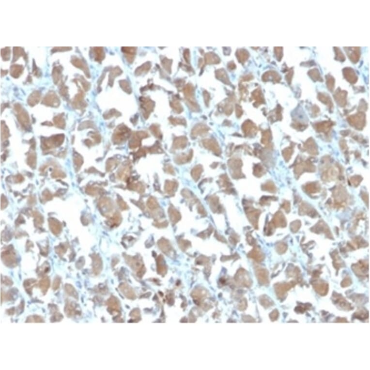 Immunohistochemistry - Anti-MICA Antibody [MICA/4442] (A277526) - Antibodies.com