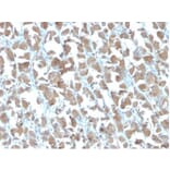 Immunohistochemistry - Anti-MICA Antibody [MICA/4442] (A277526) - Antibodies.com