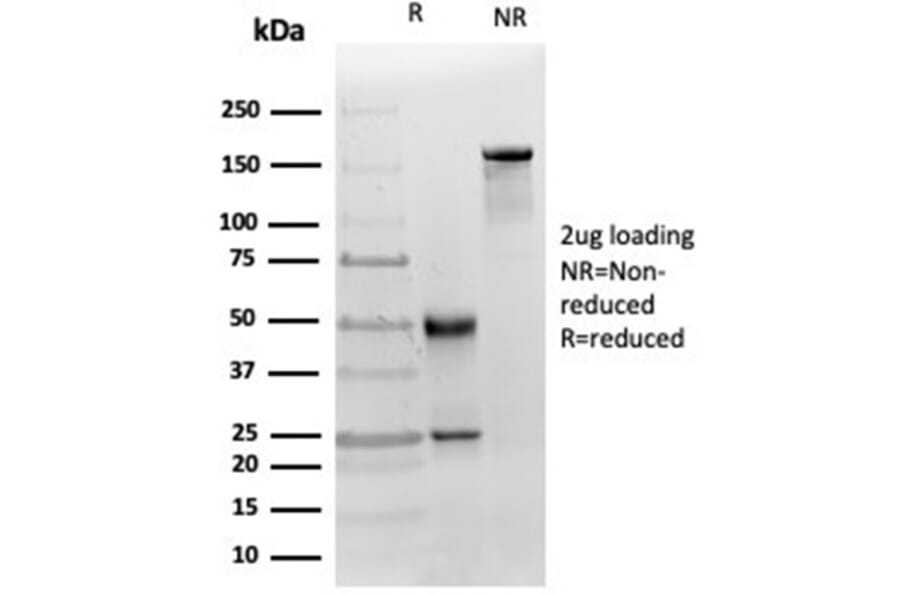 SDS-PAGE - Anti-MICA Antibody [MICA/4442] (A277526) - Antibodies.com