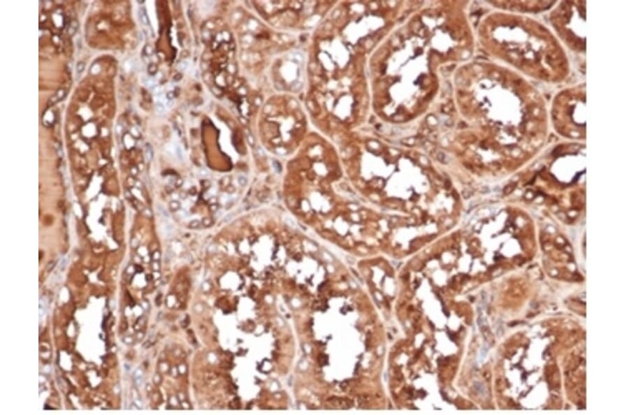 Immunohistochemistry - Anti-MICA Antibody [MICA/4443] (A277527) - Antibodies.com
