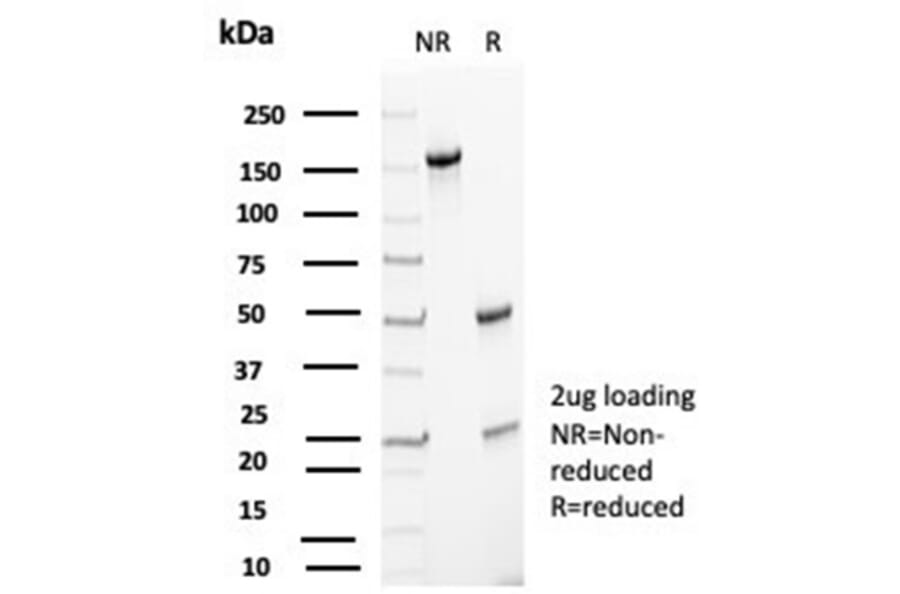 SDS-PAGE - Anti-p27 Kip1 Antibody [KIP1/1357] (A277528) - Antibodies.com