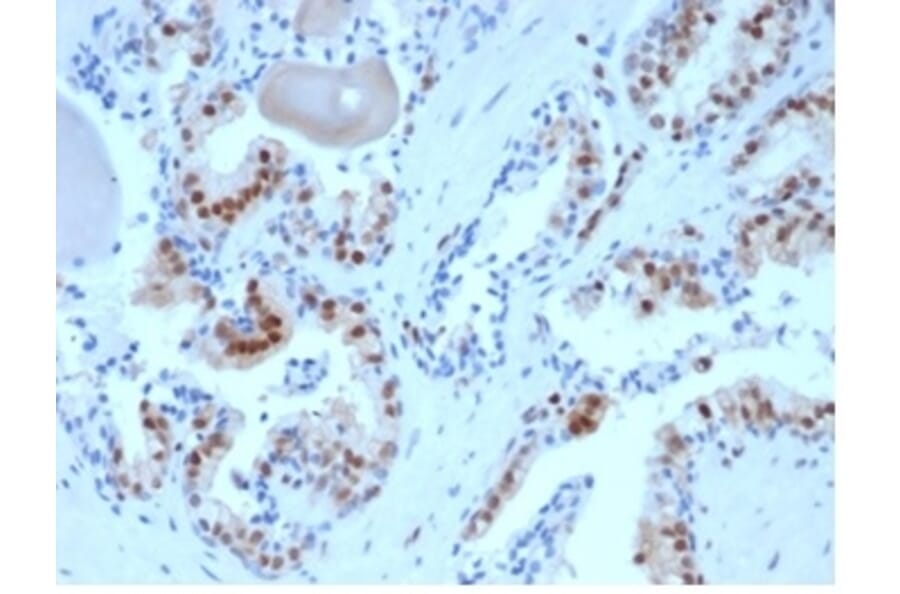 Immunohistochemistry - Anti-p27 Kip1 Antibody [KIP1/1357] (A277528) - Antibodies.com