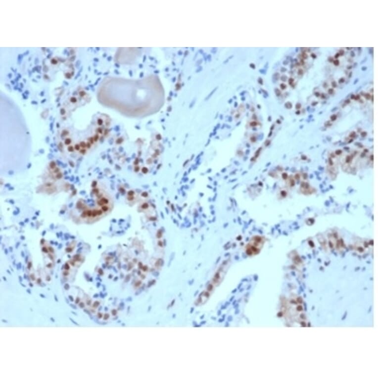 Immunohistochemistry - Anti-p27 Kip1 Antibody [KIP1/1357] (A277528) - Antibodies.com