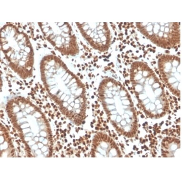 Immunohistochemistry - Anti-p27 Kip1 Antibody [KIP1/1357] (A277528) - Antibodies.com