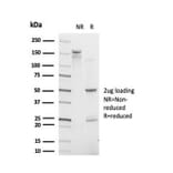 SDS-PAGE - Anti-IRF9 Antibody [PCRP-IRF9-2F8] (A277529) - Antibodies.com