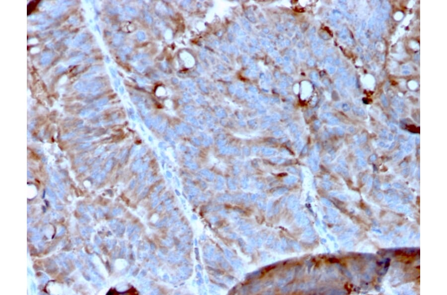 Immunohistochemistry - Anti-MerTK Antibody [MERTK/3023] (A277530) - Antibodies.com