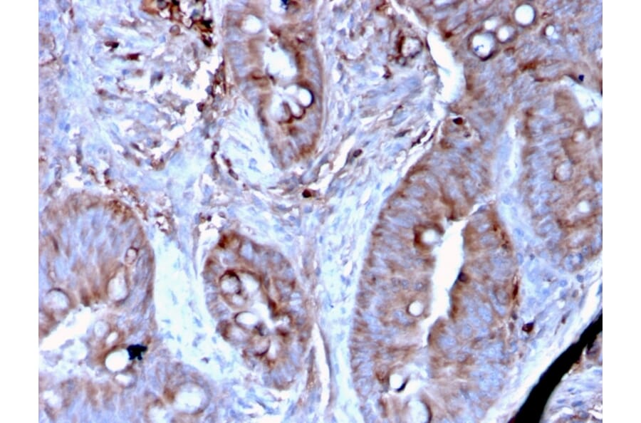 Immunohistochemistry - Anti-MerTK Antibody [MERTK/3024] (A277531) - Antibodies.com