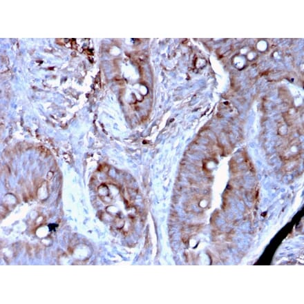 Immunohistochemistry - Anti-MerTK Antibody [MERTK/3024] (A277531) - Antibodies.com