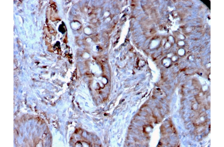 Immunohistochemistry - Anti-MerTK Antibody [MERTK/3024] (A277531) - Antibodies.com