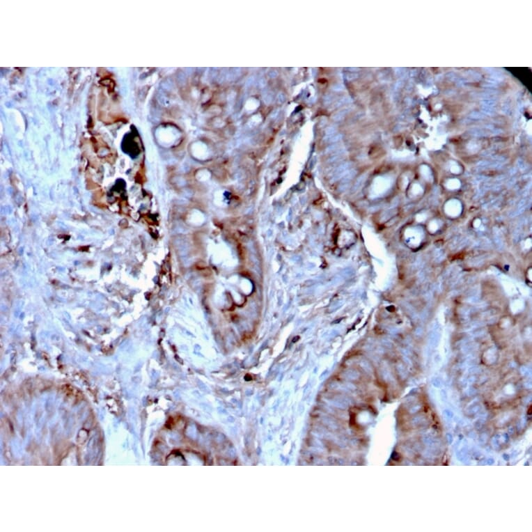 Immunohistochemistry - Anti-MerTK Antibody [MERTK/3024] (A277531) - Antibodies.com