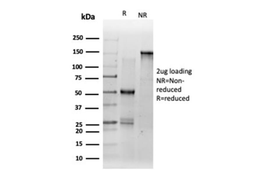 SDS-PAGE - Anti-DMRT2 Antibody [PCRP-DMRT2-1B11] (A277532) - Antibodies.com