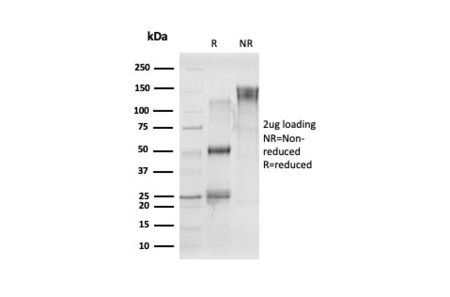 SDS-PAGE - Anti-CELF2 Antibody [PCRP-CELF2-1E4] (A277533) - Antibodies.com
