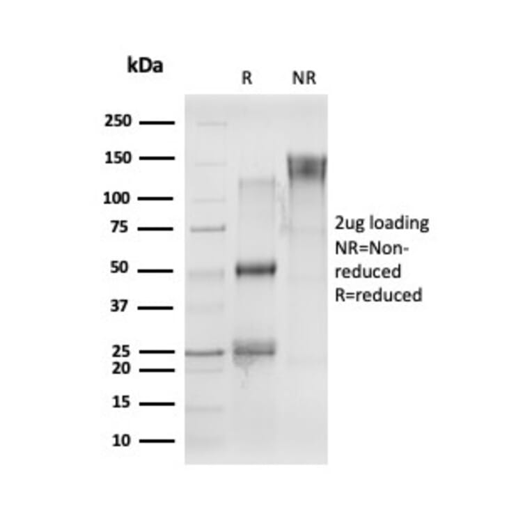 SDS-PAGE - Anti-CELF2 Antibody [PCRP-CELF2-1E4] (A277533) - Antibodies.com
