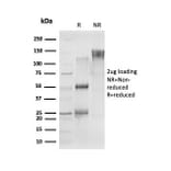 SDS-PAGE - Anti-CELF2 Antibody [PCRP-CELF2-1E4] (A277533) - Antibodies.com