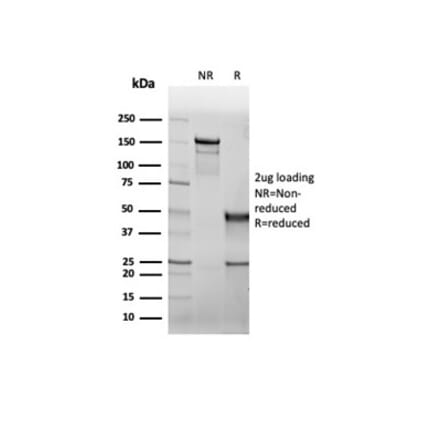 SDS-PAGE - Anti-CFTR Antibody [rCFTR/6476] (A277534) - Antibodies.com