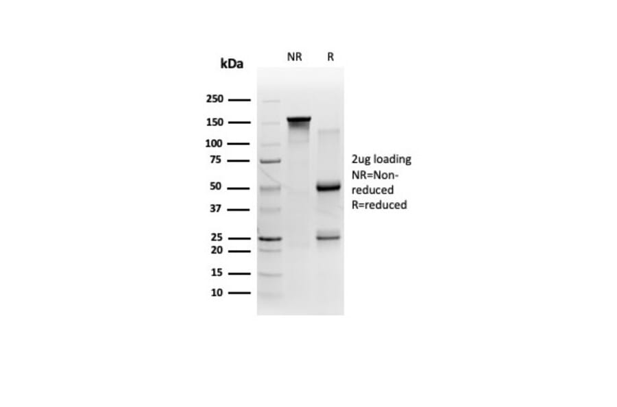 SDS-PAGE - Anti-FTCD Antibody [FTCD/357] (A277535) - Antibodies.com