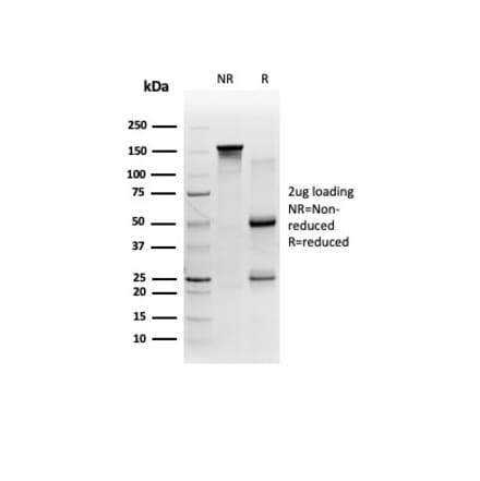 SDS-PAGE - Anti-FTCD Antibody [FTCD/357] (A277535) - Antibodies.com