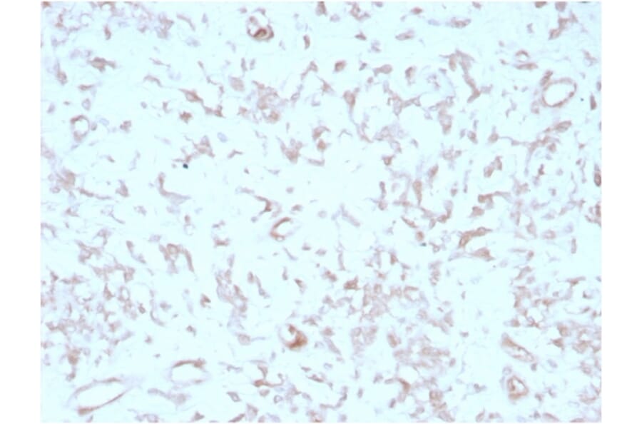 Immunohistochemistry - Anti-Kindlin 2 Antibody [3A3] (A277536) - Antibodies.com