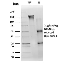SDS-PAGE - Anti-TDRKH Antibody [PCRP-TDRKH-1H2] (A277537) - Antibodies.com
