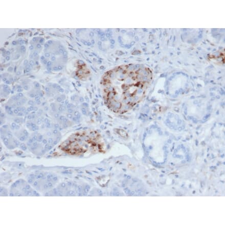 Immunohistochemistry - Anti-Chromogranin A Antibody [CHGA/4219] (A277538) - Antibodies.com