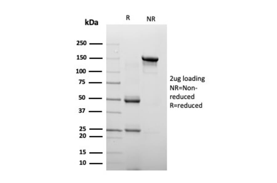 SDS-PAGE - Anti-Chromogranin A Antibody [CHGA/4223] (A277539) - Antibodies.com