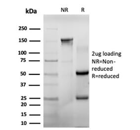 SDS-PAGE - Anti-CHEK2 Antibody [PCRP-CHEK2-1A4] (A277540) - Antibodies.com